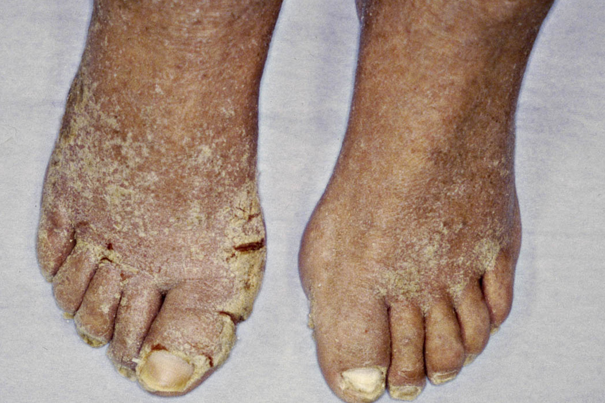 HIVinDV When to test for HIV Part 2